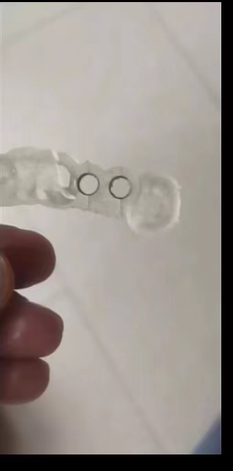 Стоматологический 3D-принтер и – обзор и цена Glue For 3D Printing