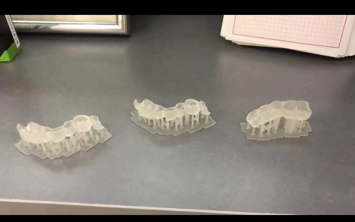 Стоматологический 3D-принтер и – обзор и цена Glue For 3D Printing